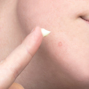Sulfur Spot Treatment